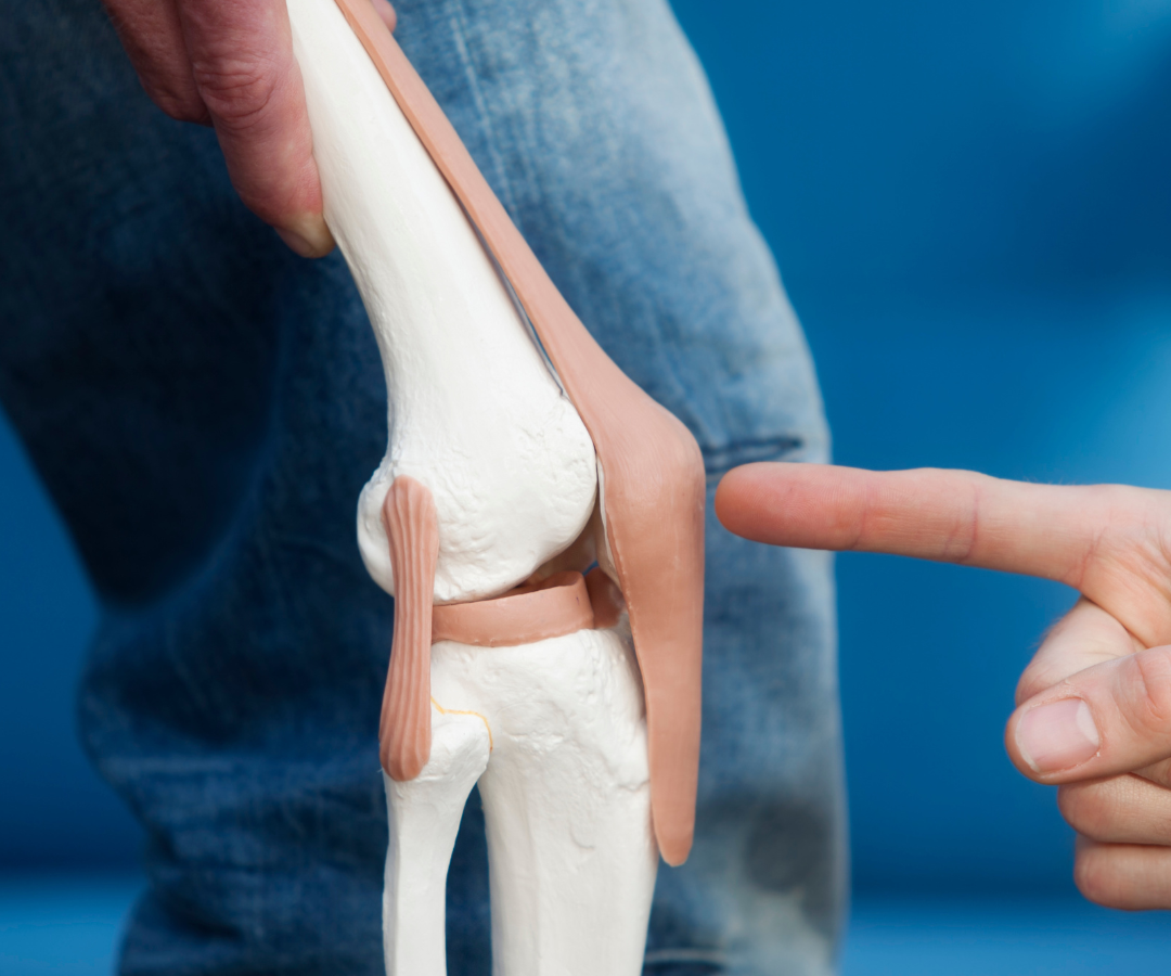 Partial Knee Replacement in Delhi